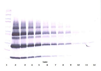 PlGF Antibody