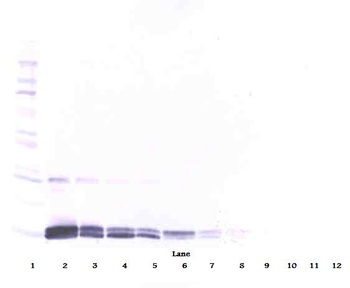 PlGF Antibody