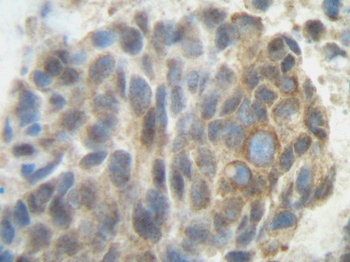 PlGF Antibody