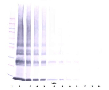 LGALS1 Antibody (Biotin)