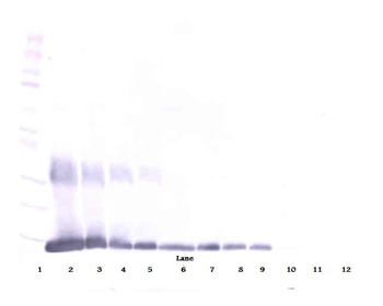 LGALS1 Antibody (Biotin)