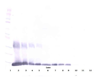 LGALS1 Antibody