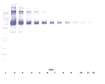 CD22 Antibody