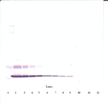 CTGF Antibody