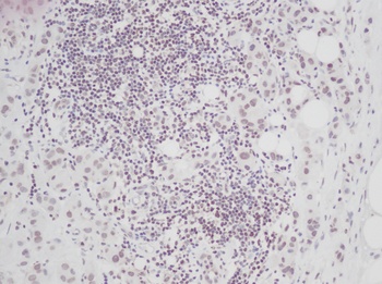 CTGF Antibody