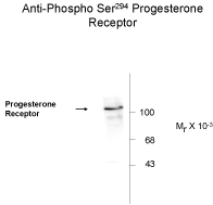 PGR Antibody