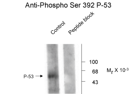 TP53 Antibody