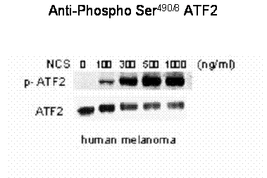 ATF2 Antibody