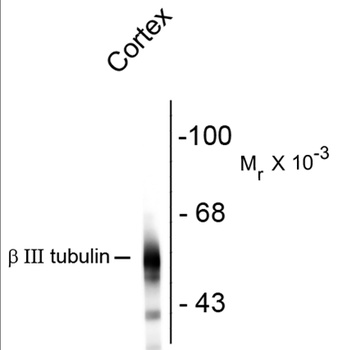 Beta III Tubulin Antibody [AA10]