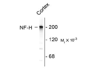 NEFH Antibody