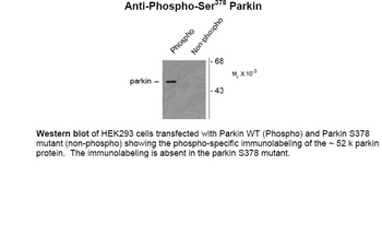 PARK2 Antibody