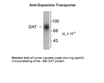 SLC6A3 Antibody