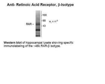 RARB Antibody