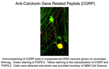 Calca Antibody