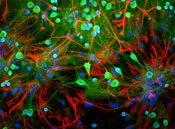 UCHL1 Antibody