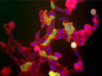 ENO2 Antibody