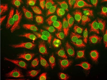 NUP98 Antibody