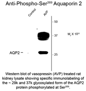 Aqp2 Antibody