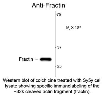 ACTB Antibody