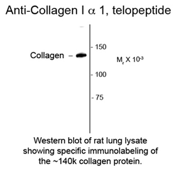 Collagen 1, alpha 1 telopeptide Antibody