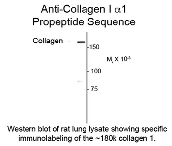 Collagen 1, alpha 1 propeptide Antibody
