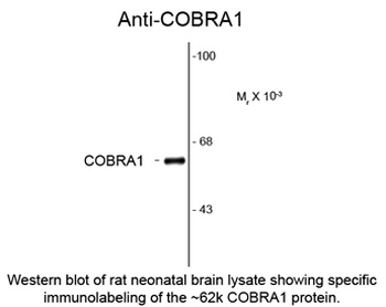 NELFB Antibody