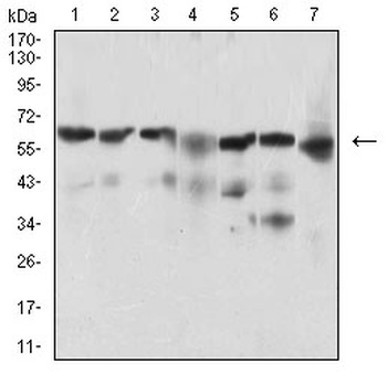 BACE1 Antibody [3C1C3]