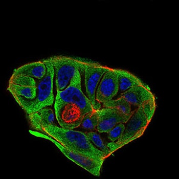 BACE1 Antibody [3C1C3]
