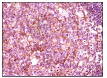 ZAP70 Antibody