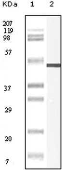 VIM Antibody