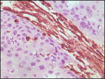 VIM Antibody