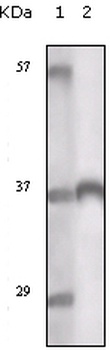 TYRO3 Antibody