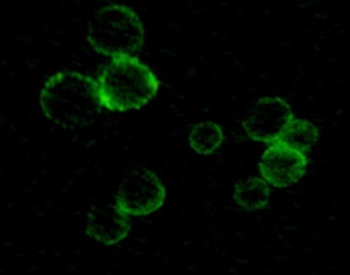 TYRO3 Antibody