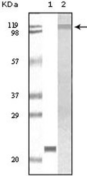 Tyk2 Antibody [8G8E9 / 8G9H5]