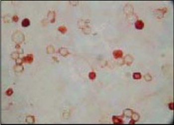 KSHVORF62 Antibody [5B7B6]