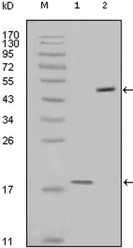 Survivin Antibody [2H5H2]