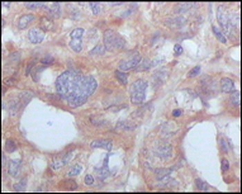 STYK1 Antibody