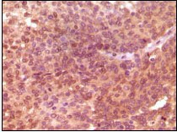 SRA Antibody [7H1G1]