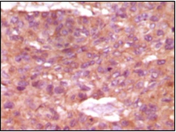 SRA1 Antibody