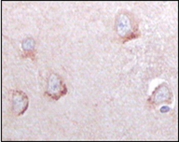 SORL1 Antibody