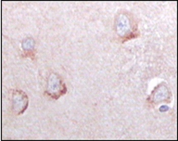 SORL1 Antibody [3B6A9 / 3B6B11]