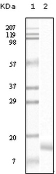 SNCG Antibody