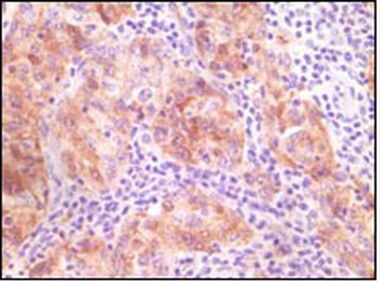 SNCG Antibody