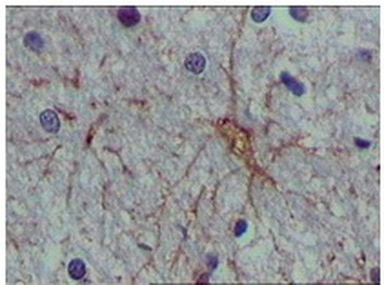 S100A1 Antibody