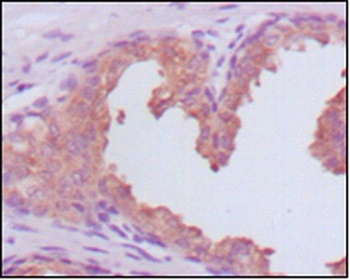 KLK3 Antibody