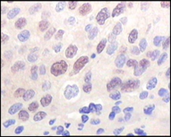 KAT8 Antibody