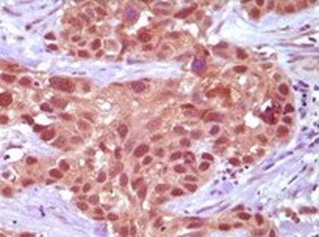 MSH2 Antibody
