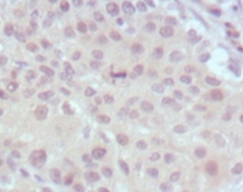 KMT2A Antibody