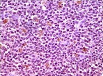 MCL1 Antibody
