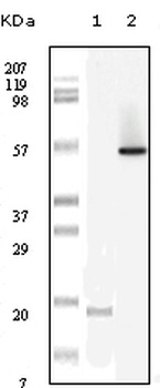 LYN Antibody